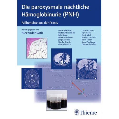 PNH - Paroxysmale nächtliche Hämoglobinurie