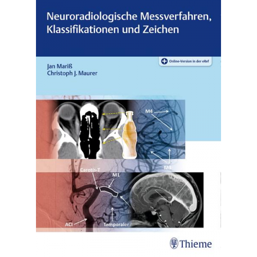 Jan Mariss & Christoph J. Maurer - Neuroradiologische Messverfahren, Klassifikationen und Zeichen