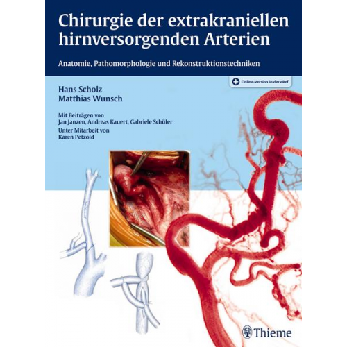 Hans Scholz & Matthias Wunsch - Chirurgie der extrakraniellen hirnversorgenden Arterien