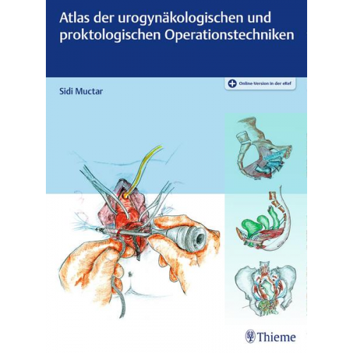 Sidi Muctar - Atlas der urogynäkologischen und proktologischen Operationstechniken