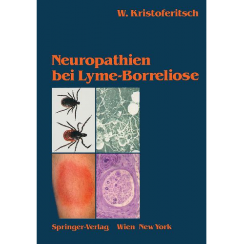 Wolfgang Kristoferitsch - Neuropathien bei Lyme-Borreliose