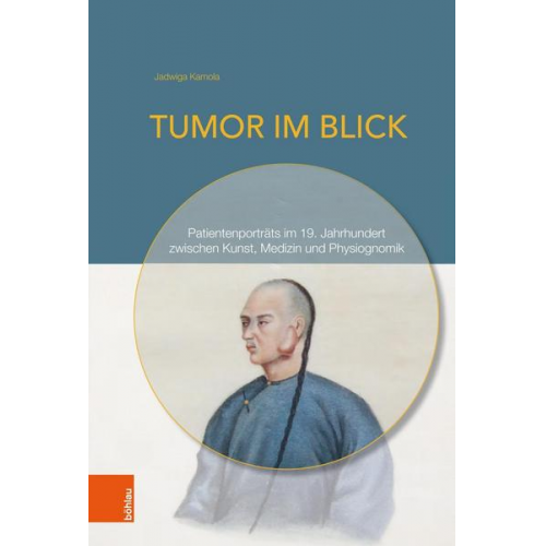 Jadwiga Kamola - Tumor im Blick