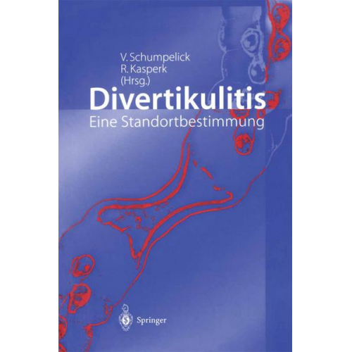 Volker Schumpelick & Reinhard Kasperk - Divertikulitis