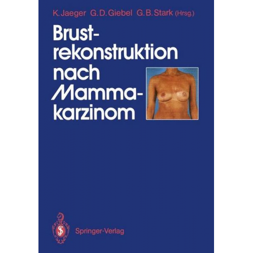 Brustrekonstruktion nach Mammakarzinom