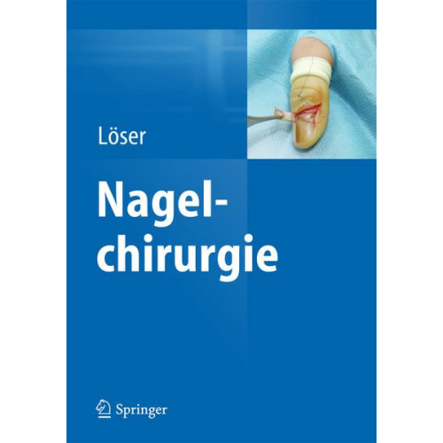 Christoph Löser - Nagelchirurgie