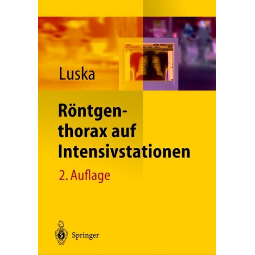 Röntgenthorax auf Intensivstationen