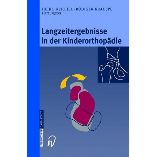 Langzeitergebnisse in der Kinderorthopädie