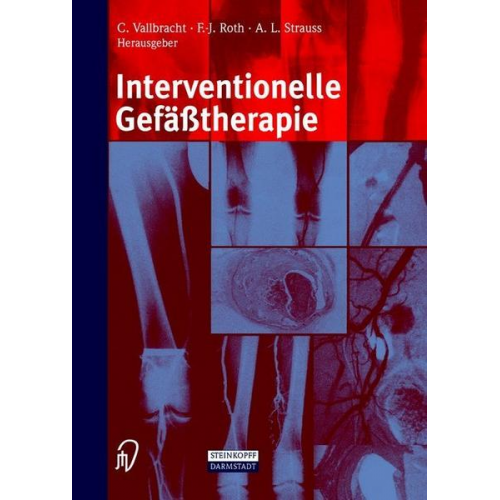 Interventionelle Gefäßtherapie