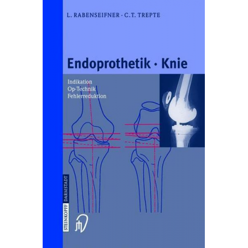 L. Rabenseifner & C. Trepte - Endoprothetik Knie