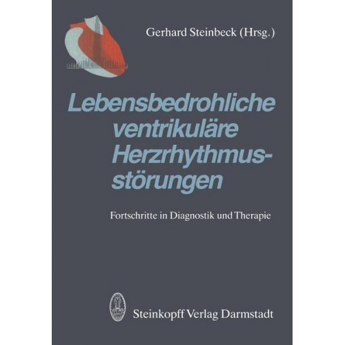 Lebensbedrohliche ventrikuläre Herzrhythmusstörungen