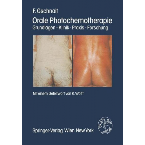 F. Gschnait - Orale Photochemotherapie