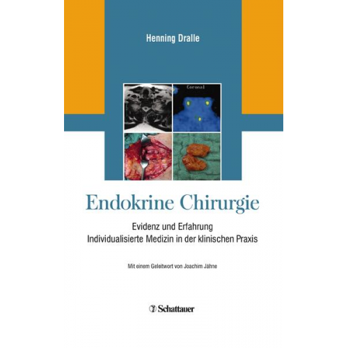 Endokrine Chirurgie