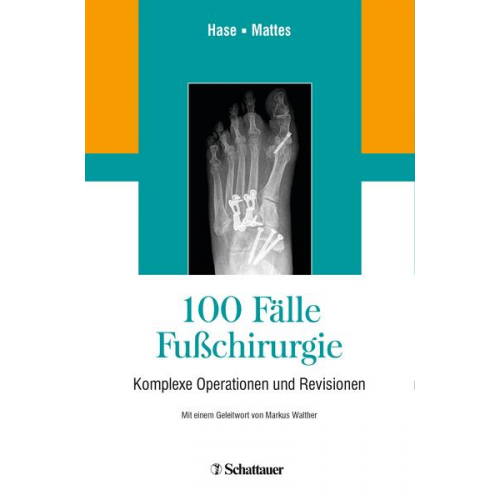 100 Fälle Fußchirurgie