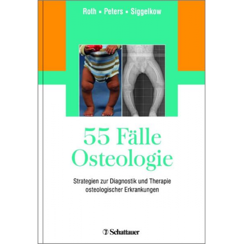 55 Fälle Osteologie