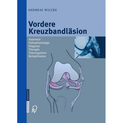 Andreas Wilcke - Vordere Kreuzbandläsion