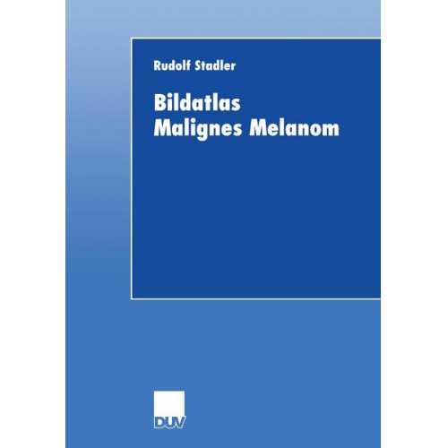 Rudolf Stadler - Bildatlas Malignes Melanom