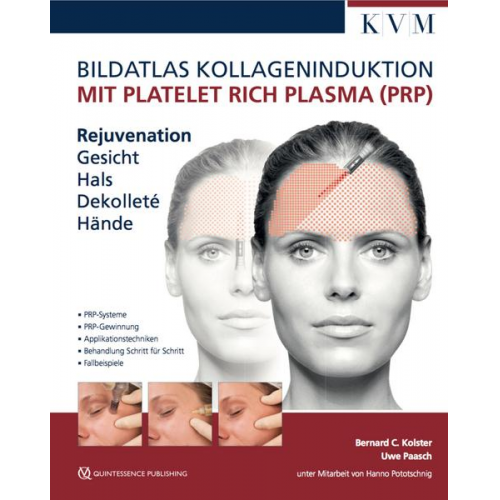 Uwe Paasch & Bernard C. Kolster - Bildatlas Kollageninduktion mit Platelet Rich Plasma (PRP)