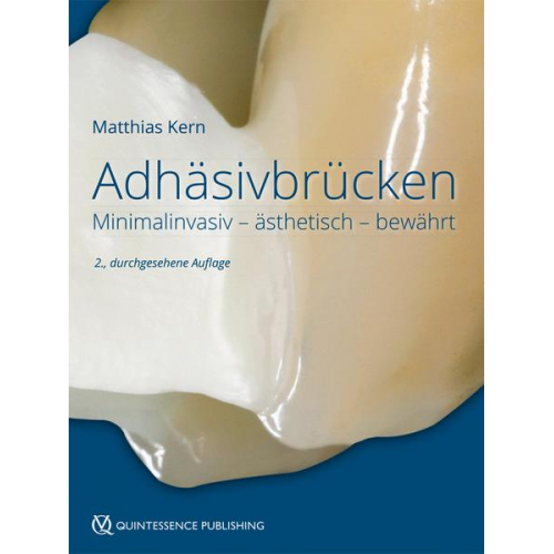 Matthias Kern - Adhäsivbrücken