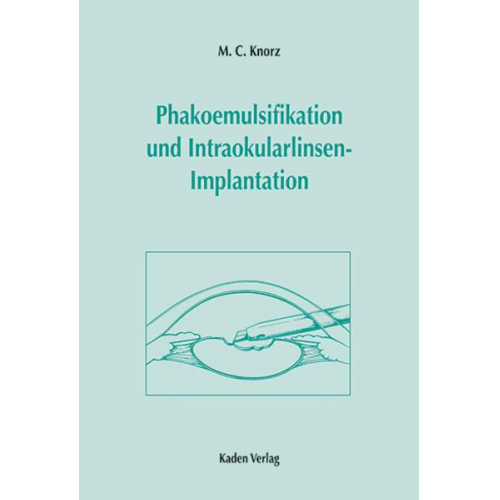 M. C. Knorz - Phakoemulsifikation und Intraokularlinsen-Implantation