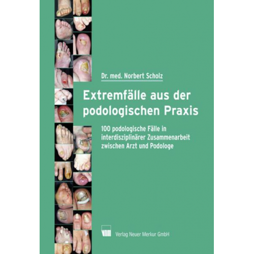 Norbert Scholz - Extremfälle aus der podologischen Praxis