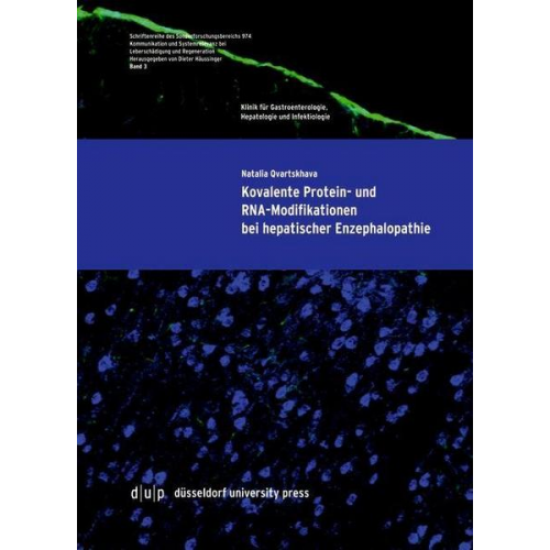 Natalia Qvartskhava - Kovalente Protein- und RNA-Modifikationen bei hepatischer Enzephalopathie