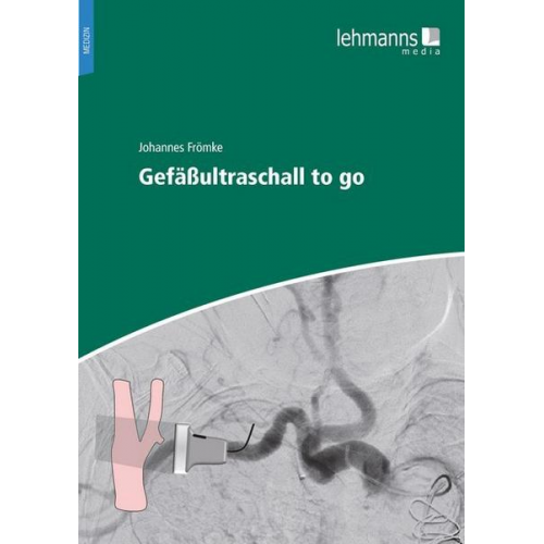 Johannes Frömke - Gefäßultraschall to go