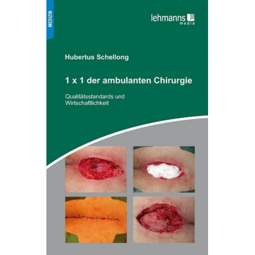 Hubertus Schellong - 1x1 der ambulanten Chirurgie