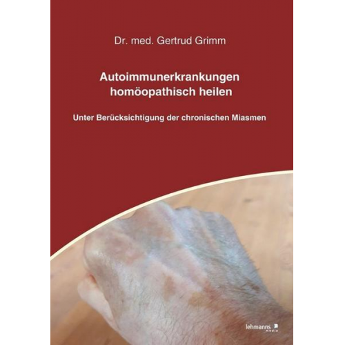 Gertrud Grimm - Autoimmunerkrankungen homöopathisch heilen