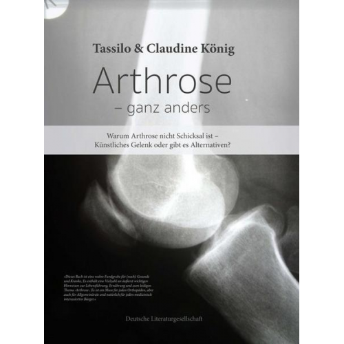 Tassilo König & Claudine König - Arthrose – ganz anders