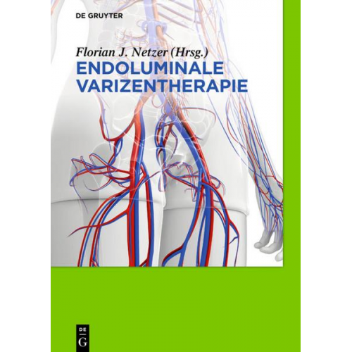 Florian Johannes Netzer - Endoluminale Varizentherapie