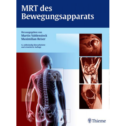 Martin Vahlensieck & Maximilian F. Reiser - MRT des Bewegungsapparats