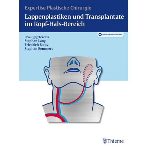 Lappenplastiken und Transplantate im Kopf-Hals-Bereich