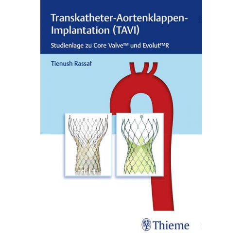 Tienush Rassaf - Transkatheter Aortenklappenimplantation (TAVI)