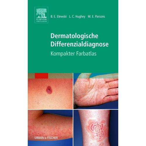 Boni E. Elewski & Lauren C. Hughey & Margaret E. Parsons - Dermatologische Differenzialdiagnose