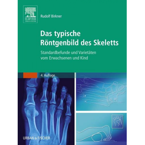 Rudolf Birkner - Das typische Röntgenbild des Skeletts