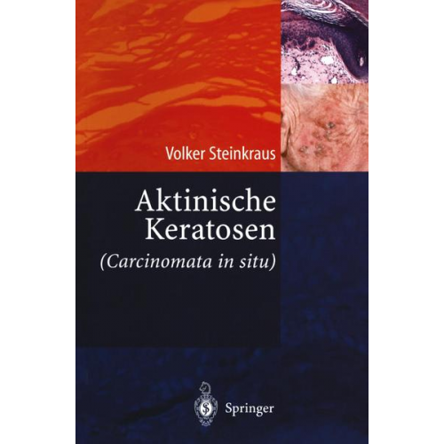 Volker Steinkraus - Aktinische Keratosen (Carcinomata in situ)