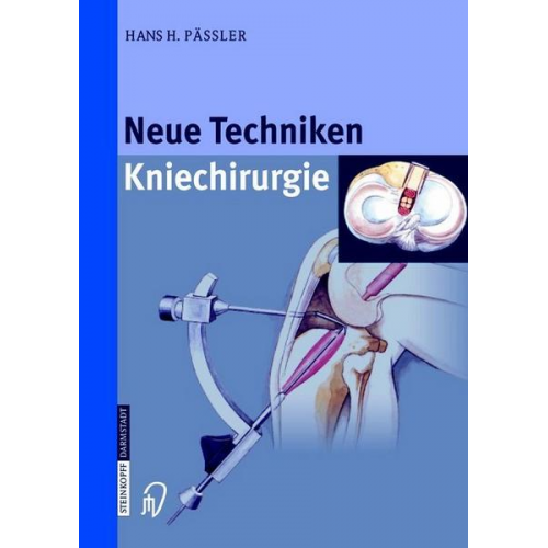 H.H. Pässler - Neue Techniken Kniechirurgie