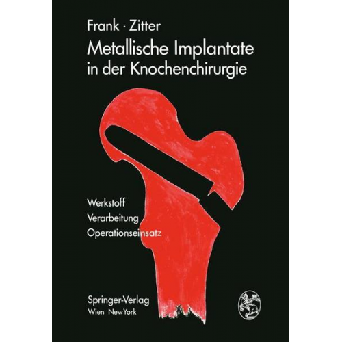 Erich Frank & Herbert Zitter - Metallische Implantate in der Knochenchirurgie