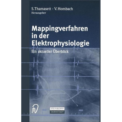 S. Thamasett & Vinzenz Hombach - Mappingverfahren in der Elektrophysiologie