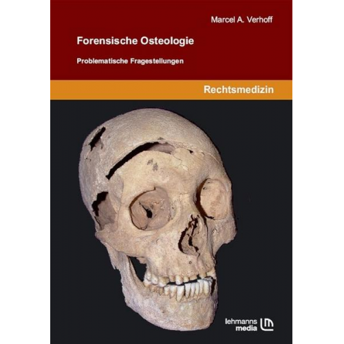 Marcel A. Verhoff - Forensische Osteologie