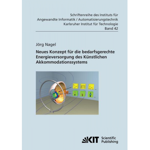 Jörg Nagel - Neues Konzept für die bedarfsgerechte Energieversorgung des Künstlichen Akkommodationssystems