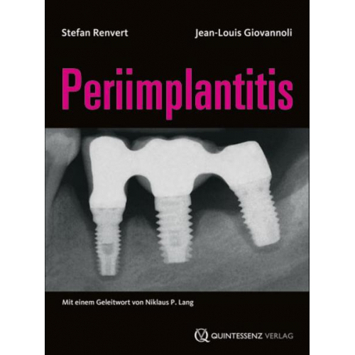 Stefan Renvert & Jean-Louis Giovannoli - Periimplantitis