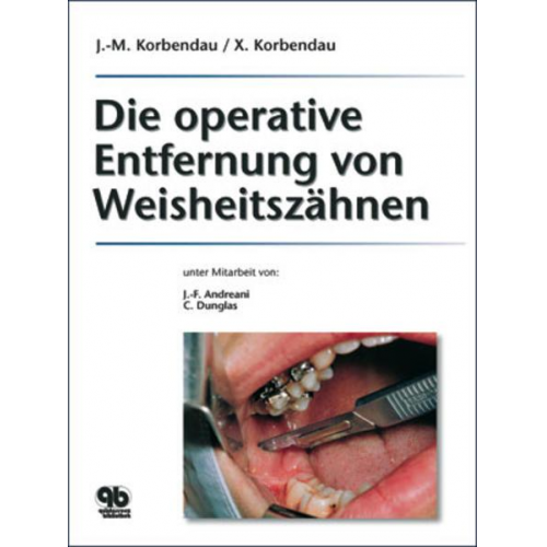 Jean Marie Korbendau & Xavier Korbendau - Die operative Entfernung von Weisheitszähnen