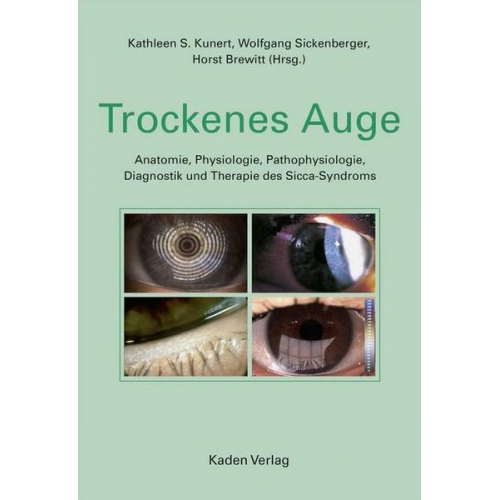 Trockenes Auge