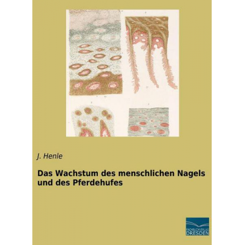 J. Henle - Henle, J: Wachstum des menschlichen Nagels und des Pferdehuf