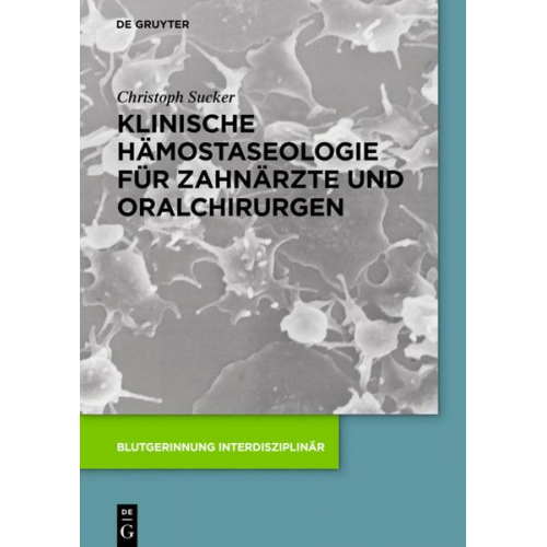 Christoph Sucker - Klinische Hämostaseologie für Zahnärzte und Oralchirurgen