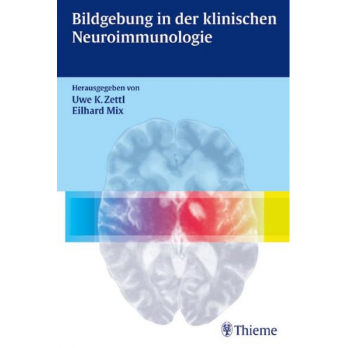 Eilhard Mix & Uwe Klaus Zettl - Bildgebung in der klinischen Neuroimmunologie