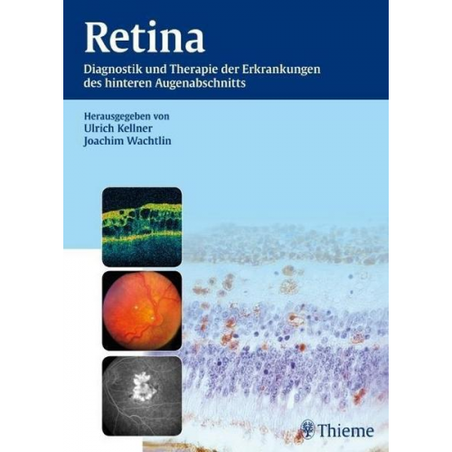 Joachim Wachtlin & Ulrich Kellner - Retina