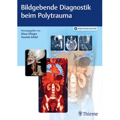 Bildgebende Diagnostik beim Polytrauma