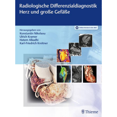 Radiologische Differenzialdiagnostik Herz und große Gefäße